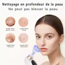 Aspirateur à points noirs - SIMPLY BEAUTIFUL